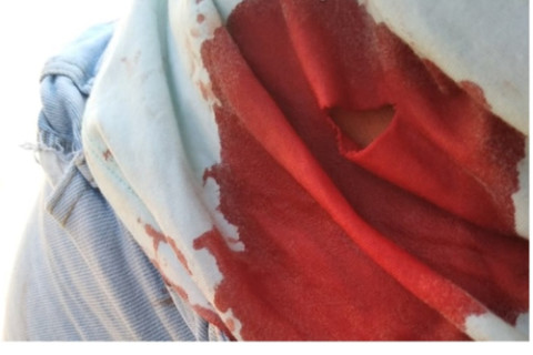 Mulher é atingida por golpe de faca a caminho do trabalho na cidade de Três Passos